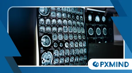 Predictive Brain Models Are Changing Neuroscience